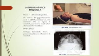 SUBMENTOVÉRTICE
MANDIBULA
Chassi: 18 x 24 sentido longitudinal.
RC: alinhar o RC perpendicularmente
ao RI ou a LIOM, centralizar um ponto
intermédio entre os ângulos da
mandíbula, ou a um nível situado a 4 cm
abaixo da sínfise mandibular.
DFOFI: 100 cm.
Patologia demosntrada: fratura e
processos neoplásicos e inflamatórios da
mandíbula.
 