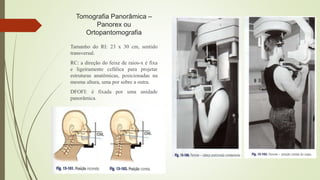 Tomografia Panorâmica –
Panorex ou
Ortopantomografia
Tamanho do RI: 23 x 30 cm, sentido
transversal.
RC: a direção do feixe de raios-x é fixa
e ligeiramente cefálica para projetar
estruturas anatômicas, posicionadas na
mesma altura, uma por sobre a outra.
DFOFI: é fixada por uma unidade
panorâmica.
 