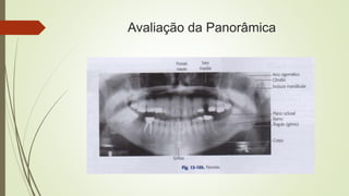 Avaliação da Panorâmica
 