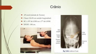 Crânio
 AP axial (método de Towne).
 Chassi 24x30 cm sentido longitudinal.
 RC a 30º da LOM ou a 37º da LIOM.
 DFOFI: 100 cm.
 