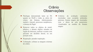Crânio
Observações
 Patologia demonstrada tanto no PA
quanto no Perfil e todas as séries do
crânio: são fraturas, (deslocamento
medial e lateral), processos neoplásicos,
e doença de Paget.
 Remover todos os objetos de metal,
plástico, e demais objetos situados na
região de interesse, realizar o exame com
paciente em decúbito dorsal, ou em
posição ereta.
 Respiração: prender respiração.
 Colimação: colimar as margens externas
do crânio.
 Critérios de avaliação estruturas
mostradas: osso occipital, pirâmides
petrosas, forame magno são mostrados
com o dorso da sela posteriores
visualizados na sombra do forame
magno.
 