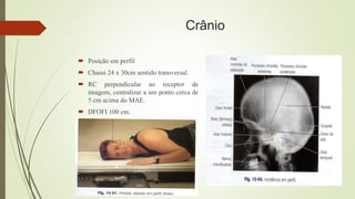 Crânio
 Posição em perfil
 Chassi 24 x 30cm sentido transversal.
 RC perpendicular ao receptor de
imagem, centralizar a um ponto cerca de
5 cm acima do MAE.
 DFOFI 100 cm.
 