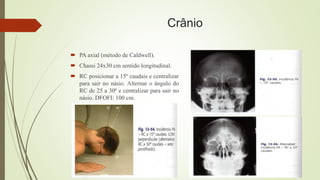 Crânio
 PA axial (método de Caldwell).
 Chassi 24x30 cm sentido longitudinal.
 RC posicionar a 15º caudais e centralizar
para sair no násio. Alternar o ângulo do
RC de 25 a 30º e centralizar para sair no
násio. DFOFI: 100 cm.
 