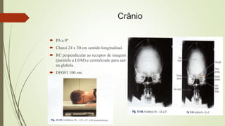 Crânio
 PA a 0º
 Chassi 24 x 30 cm sentido longitudinal.
 RC perpendicular ao receptor de imagem
(paralelo a LOM) e centralizado para sair
na glabela.
 DFOFI 100 cm.
 