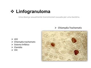  Linfogranuloma
Uma doença sexualmente transmissível causada por uma bactéria.
 LGV
 Chlamydia trachomatis
 Sistema linfático
 Clamídia
 VIH
 Chlamydia Trachomatis
 