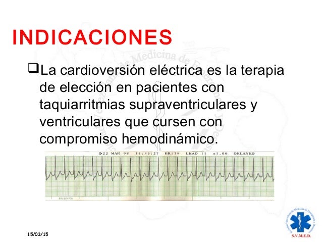 DIFERENCIA ENTRE CARDIOVERSION Y DESFIBRILACION PDF