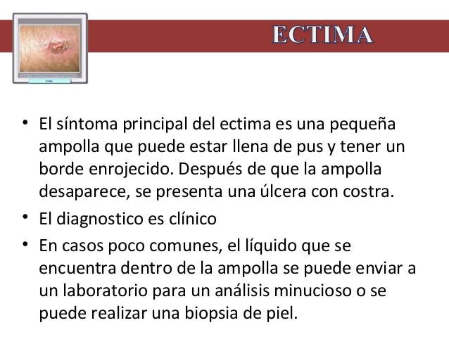 La presentación al tema la conducta que declina el alcoholismo