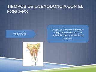 TIEMPOS DE LA EXODONCIA CON EL
FORCEPS
TRACCIÓN:
Desplaza el diente del alveolo
luego de su dilatación. En
aplicación del movimiento de
rotación.
 