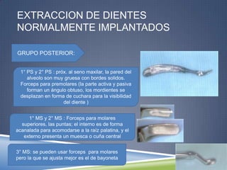 EXTRACCION DE DIENTES
NORMALMENTE IMPLANTADOS
GRUPO POSTERIOR:
1° PS y 2° PS : próx. al seno maxilar, la pared del
alveolo son muy gruesa con bordes solidos.
Forceps para premolares (la parte activa y pasiva
forman un ángulo obtuso, los mordientes se
desplazan en forma de cuchara para la visibilidad
del diente )
1° MS y 2° MS : Forceps para molares
superiores, las puntas; el interno es de forma
acanalada para acomodarse a la raíz palatina, y el
externo presenta un muesca o cuña central
3° MS: se pueden usar forceps para molares
pero la que se ajusta mejor es el de bayoneta
 