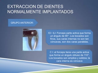 EXTRACCION DE DIENTES
NORMALMENTE IMPLANTADOS
GRUPO ANTERIOR:
ICI ILI: Forceps parte activa que forma
un ángulo de 90°. Los bocados son
finos, sus caras internas no son tan
cóncavas, son dos caras paralelas.
C I: el forceps tiene una parte activa
que forma un ángulo obtuso de 110°.
Los bocados son amplios y solidos; la
cara interna es cóncava
 