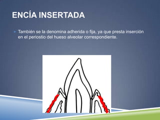 ENCÍA INSERTADA
 También se la denomina adherida o fija, ya que presta inserción
en el periostio del hueso alveolar correspondiente.
 