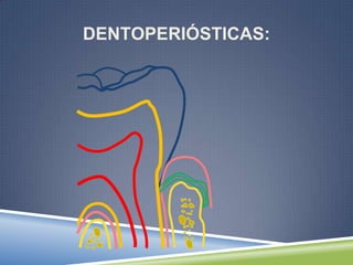 DENTOPERIÓSTICAS:
 