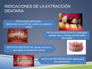 INDICACIONES DE LA EXTRACCIÓN
DENTARIA
PATOLOGÍA DENTARIA :
destrucción de la CD por caries con afección
pulpar
PATOLOGÍA PERIODONTAL avanzada:
perdida ósea y bolsas periodontales
bifurcadas
MOTIVOS PROTÉSICOS: diente extruido o
que altere la dimensión vertical
MOTIVOS ORTODONCICOS: dependerá
del especialista .
 