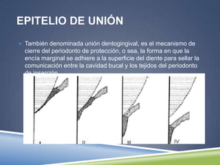 EPITELIO DE UNIÓN
 También denominada unión dentogingival, es el mecanismo de
cierre del periodonto de protección, o sea, la forma en que la
encía marginal se adhiere a la superficie del diente para sellar la
comunicación entre la cavidad bucal y los tejidos del periodonto
de inserción.
 
