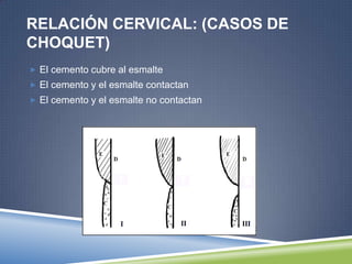 RELACIÓN CERVICAL: (CASOS DE
CHOQUET)
 El cemento cubre al esmalte
 El cemento y el esmalte contactan
 El cemento y el esmalte no contactan
 