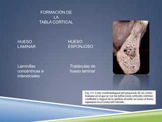 FORMACIÓN DE
LA
TABLA CORTICAL
HUESO
LAMINAR
HUESO
ESPONJOSO
Laminillas
concéntricas e
intersticiales
Trabéculas de
hueso laminar
 