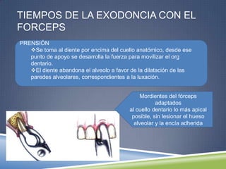 TIEMPOS DE LA EXODONCIA CON EL
FORCEPS
PRENSIÓN
Se toma al diente por encima del cuello anatómico, desde ese
punto de apoyo se desarrolla la fuerza para movilizar el org
dentario.
El diente abandona el alveolo a favor de la dilatación de las
paredes alveolares, correspondientes a la luxación.
Mordientes del fórceps
adaptados
al cuello dentario lo más apical
posible, sin lesionar el hueso
alveolar y la encía adherida
 
