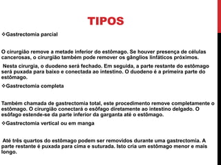 TIPOS
Gastrectomia parcial
O cirurgião remove a metade inferior do estômago. Se houver presença de células
cancerosas, o cirurgião também pode remover os gânglios linfáticos próximos.
Nesta cirurgia, o duodeno será fechado. Em seguida, a parte restante do estômago
será puxada para baixo e conectada ao intestino. O duodeno é a primeira parte do
estômago.
Gastrectomia completa
Também chamada de gastrectomia total, este procedimento remove completamente o
estômago. O cirurgião conectará o esôfago diretamente ao intestino delgado. O
esôfago estende-se da parte inferior da garganta até o estômago.
Gastrectomia vertical ou em manga
Até três quartos do estômago podem ser removidos durante uma gastrectomia. A
parte restante é puxada para cima e suturada. Isto cria um estômago menor e mais
longo.
 