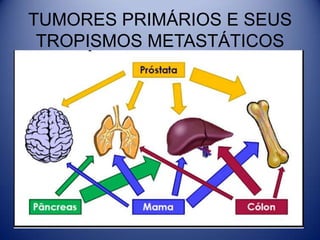 TUMORES PRIMÁRIOS E SEUS
TROPISMOS METASTÁTICOS
 