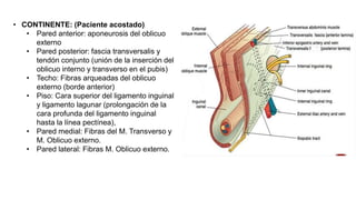 • CONTINENTE: (Paciente acostado)
• Pared anterior: aponeurosis del oblicuo
externo
• Pared posterior: fascia transversalis y
tendón conjunto (unión de la inserción del
oblicuo interno y transverso en el pubis)
• Techo: Fibras arqueadas del oblicuo
externo (borde anterior)
• Piso: Cara superior del ligamento inguinal
y ligamento lagunar (prolongación de la
cara profunda del ligamento inguinal
hasta la línea pectínea),
• Pared medial: Fibras del M. Transverso y
M. Oblicuo externo.
• Pared lateral: Fibras M. Oblicuo externo.
 