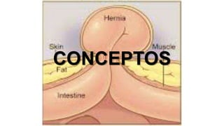 CONCEPTOS
 