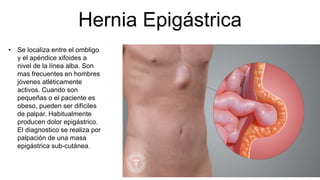 Hernia Epigástrica
• Se localiza entre el ombligo
y el apéndice xifoides a
nivel de la línea alba. Son
mas frecuentes en hombres
jóvenes atléticamente
activos. Cuando son
pequeñas o el paciente es
obeso, pueden ser difíciles
de palpar. Habitualmente
producen dolor epigástrico.
El diagnostico se realiza por
palpación de una masa
epigástrica sub-cutánea.
 