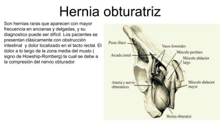 Hernia obturatriz
Son hernias raras que aparecen con mayor
frecuencia en ancianas y delgadas, y su
diagnostico puede ser difícil. Los pacientes se
presentan clásicamente con obstrucción
intestinal y dolor localizado en el tacto rectal. El
dolor a lo largo de la zona media del muslo (
signo de Howship-Romberg) la cual se debe a
la compresión del nervio obturador
 