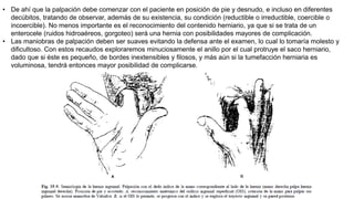 • De ahí que la palpación debe comenzar con el paciente en posición de pie y desnudo, e incluso en diferentes
decúbitos, tratando de observar, además de su existencia, su condición (reductible o irreductible, coercible o
incoercible). No menos importante es el reconocimiento del contenido herniario, ya que si se trata de un
enterocele (ruidos hidroaéreos, gorgoteo) será una hernia con posibilidades mayores de complicación.
• Las maniobras de palpación deben ser suaves evitando la defensa ante el examen, lo cual lo tomaría molesto y
dificultoso. Con estos recaudos exploraremos minuciosamente el anillo por el cual protruye el saco herniario,
dado que si éste es pequeño, de bordes inextensibles y filosos, y más aún si la tumefacción herniaria es
voluminosa, tendrá entonces mayor posibilidad de complicarse.
 