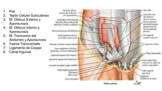 1. Piel
2. Tejido Celular Subcutáneo
3. M. Oblicuo Externo y
Aponeurosis
4. M. Oblicuo Interno y
Aponeurosis
5. M. Transverso del
Abdomen y Aponeurosis
6. Fascia Transversalis
7. Ligamento de Cooper
8. Canal Inguinal
 