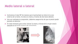 Medio lateral o lateral
 Inclinamos el tubo 90º de manera que el portachasis se sitúe en la cara
externa de la mama. Se eleva la mama y tiramos de ella hacia delante.
 Una vez realizada la compresión, debemos asegurarnos de que el pezón quede
paralelo al detector.
 En todo momento para evitar retraer la mama, el brazo de la mujer estará
apoyado en el borde externo del portachasis.
 