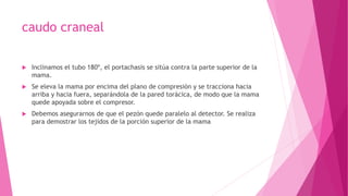 caudo craneal
 Inclinamos el tubo 180º, el portachasis se sitúa contra la parte superior de la
mama.
 Se eleva la mama por encima del plano de compresión y se tracciona hacia
arriba y hacia fuera, separándola de la pared torácica, de modo que la mama
quede apoyada sobre el compresor.
 Debemos asegurarnos de que el pezón quede paralelo al detector. Se realiza
para demostrar los tejidos de la porción superior de la mama
 