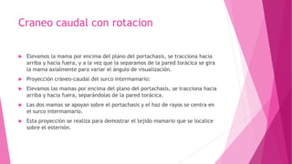 Craneo caudal con rotacion
 Elevamos la mama por encima del plano del portachasis, se tracciona hacia
arriba y hacia fuera, y a la vez que la separamos de la pared torácica se gira
la mama axialmente para variar el ángulo de visualización.
 Proyección cráneo-caudal del surco intermamario:
 Elevamos las mamas por encima del plano del portachasis, se tracciona hacia
arriba y hacia fuera, separándolas de la pared torácica.
 Las dos mamas se apoyan sobre el portachasis y el haz de rayos se centra en
el surco intermamario.
 Esta proyección se realiza para demostrar el tejido mamario que se localice
sobre el esternón.
 