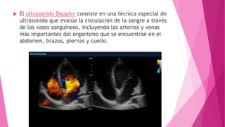  El ultrasonido Doppler consiste en una técnica especial de
ultrasonido que evalúa la circulación de la sangre a través
de los vasos sanguíneos, incluyendo las arterias y venas
más importantes del organismo que se encuentran en el
abdomen, brazos, piernas y cuello.
 