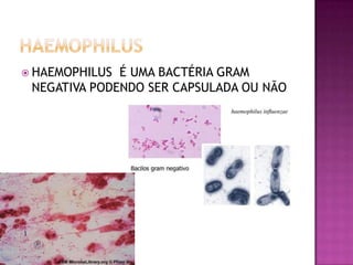  HAEMOPHILUS É UMA BACTÉRIA GRAM
 NEGATIVA PODENDO SER CAPSULADA OU NÃO
 