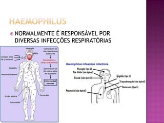  NORMALMENTE  É RESPONSÁVEL POR
 DIVERSAS INFECÇÕES RESPIRATÓRIAS
 