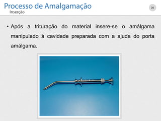 • Após a trituração do material insere-se o amálgama
manipulado à cavidade preparada com a ajuda do porta
amálgama.
26
 
