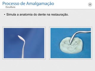 29
• Simula a anatomia do dente na restauração.
 