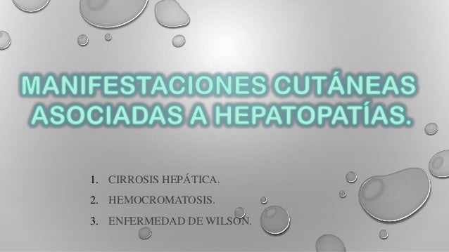 Las pecas a los niños morenos