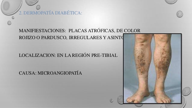 Porno las estrellas con el pecho de silicio porno