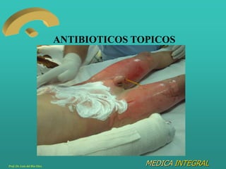 MEDICA INTEGRAL
ANTIBIOTICOS TOPICOS
Prof. Dr. Luis del Rio Diez
 