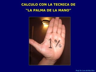 CALCULO CON LA TECNICA DE
“LA PALMA DE LA MANO”
Prof. Dr. Luis del Rio Diez
 