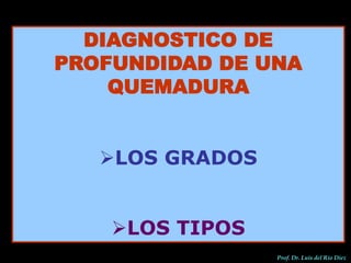 DIAGNOSTICO DE
PROFUNDIDAD DE UNA
QUEMADURA
LOS GRADOS
LOS TIPOS
Prof. Dr. Luis del Rio Diez
 