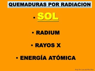 QUEMADURAS POR RADIACION
• SOL
• RADIUM
• RAYOS X
• ENERGÍA ATÓMICA
Prof. Dr. Luis del Rio Diez
 