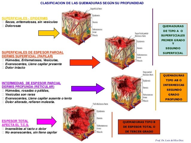 seminario-de-quemaduras-en-clinica-quirurgica