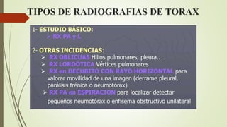 TIPOS DE RADIOGRAFIAS DE TORAX
 
