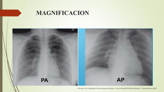 MAGNIFICACION
 