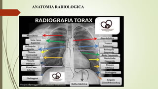 ANATOMIA RADIOLOGICA
 