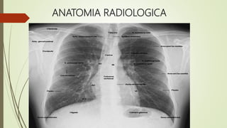 ANATOMIA RADIOLOGICA
 