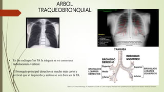 ARBOL
TRAQUEOBRONQUIAL
• En las radiografías PA la tráquea se ve como una
radiolucencia vertical.
• El bronquio principal derecho es mucho más corto y
vertical que el izquierdo y ambos se ven bien en la PA.
”Basics of Chest Radiology, A Beginner’s Guide to Chest maging”Revised and Updated Fourth Edition,JM Books’ Medical Division.
 