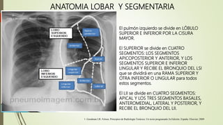 ANATOMIA LOBAR Y SEGMENTARIA
• El pulmón izquierdo se divide en LÓBULO
SUPERIOR E INFERIOR POR LA CISURA
MAYOR.
• El SUPERIOR se divide en CUATRO
SEGMENTOS: LOS SEGMENTOS
APICOPOSTERIOR Y ANTERIOR, Y LOS
SEGMENTOS SUPERIOR E INFERIOR
LINGULAR Y RECIBE EL BRONQUIO DEL LSI
que se dividirá en una RAMA SUPERIOR Y
OTRA INFERIOR O LINGULAR para todos
estos segmentos.
• El LII se divide en CUATRO SEGMENTOS:
APICAL Y LOS TRES SEGMENTOS BASALES,
ANTEROMEDIAL, LATERAL Y POSTERIOR, Y
RECIBE EL BRONQUIO DEL LII.
1. Goodman LR. Felson. Principios de Radiología Torácica. Un texto programado.3a Edición. España: Elsevier; 2009
 